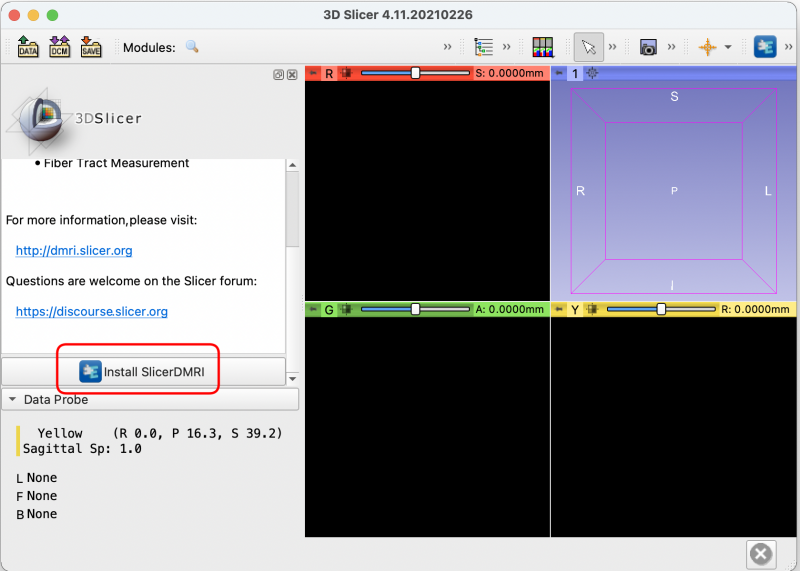 Install SlicerDMRI